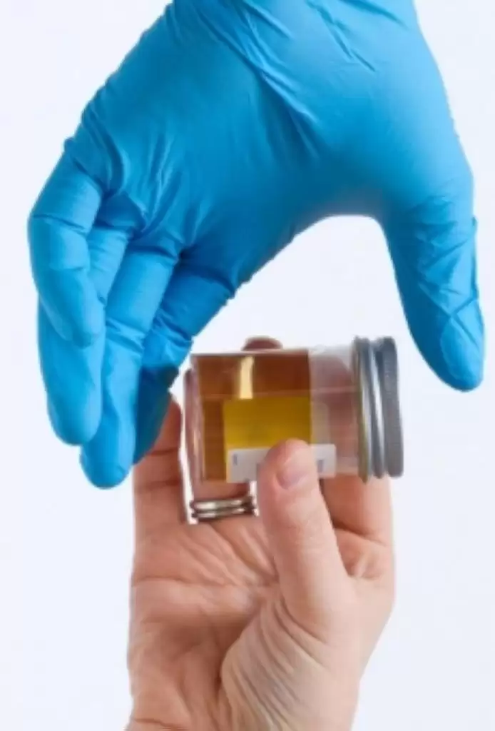 Dua Pejabat Labuhanbatu  Diminta Tes Urine Jajaran