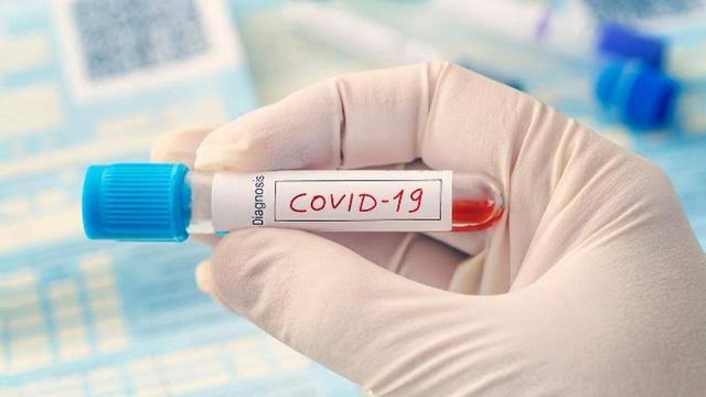 Tenaga Medis Positif Covid-19, Poliklinik RSUD Siak Ditutup