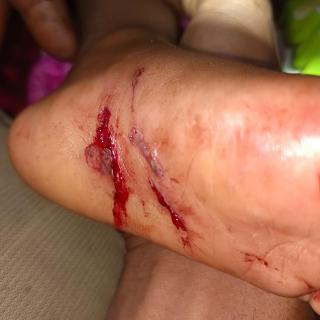Ngeri, Begini Kronologis Anak Pekerja PT TFDI Diserang Harimau di Camp