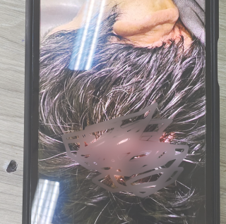 Kematian Karyawan Inecda Janggal, Polisi Sedang Dalami Motif