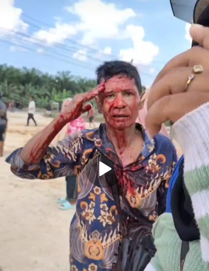 Peritiwa Berdarah di Duri 13! Warga Kerapatan Adat Sakai Terluka Diserang Karyawan PT SIS