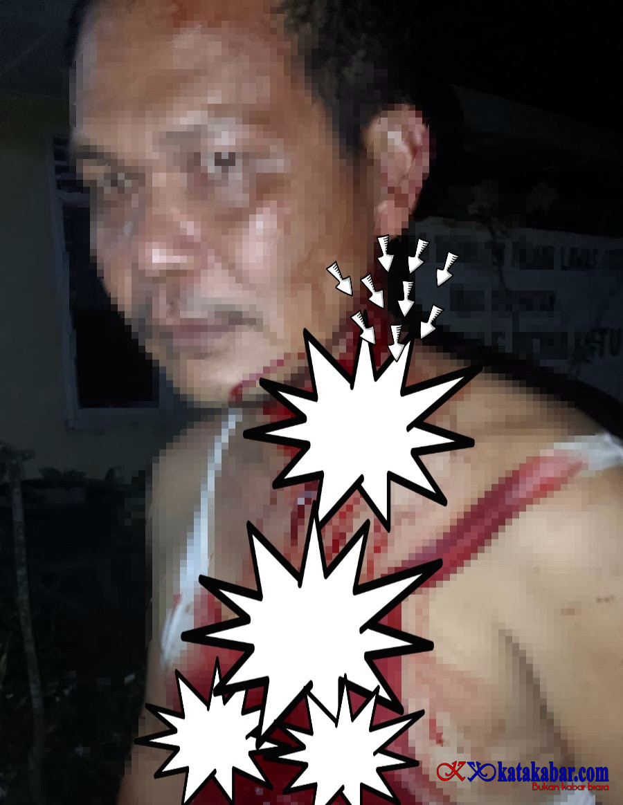 Hukum Dinilai Tumpul! Oknum Kades Diduga Bacok Warga Masih Bebas Polsek Dolok Didesak Bertindak