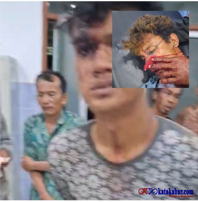 Tragedi Berdarah di Batang Kumu II: 26 Pekerja Dihajar Ratusan Orang Bersenjata, Agrinas Diduga Terlibat!