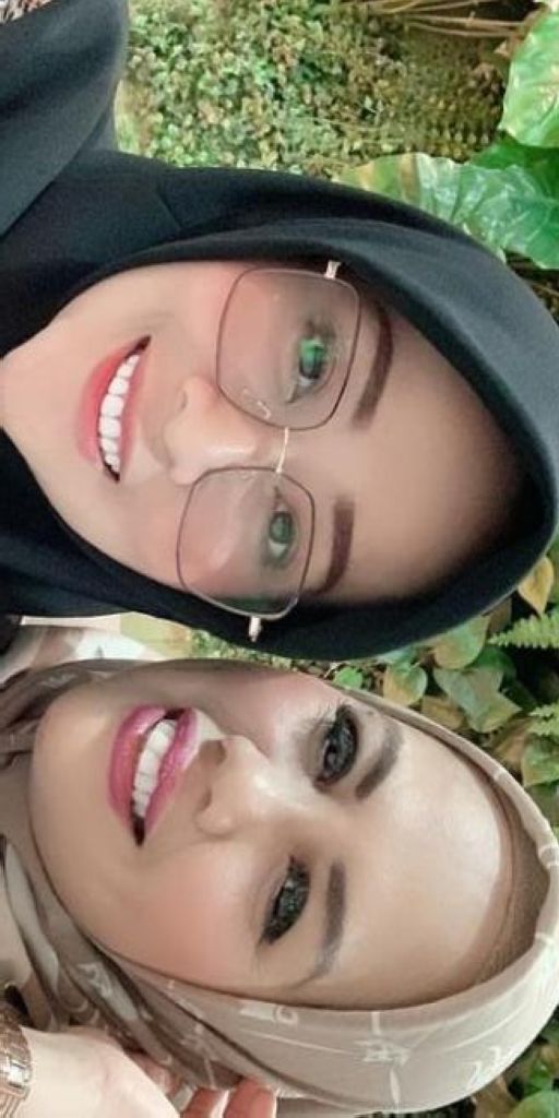 Potret Terbaru Elly Sugigi Usai Potong Gigi, Terlihat Beda Banget
